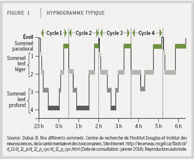 Hypnogramme typique